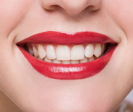 How to get beautiful White Teeth without any Side Effects!